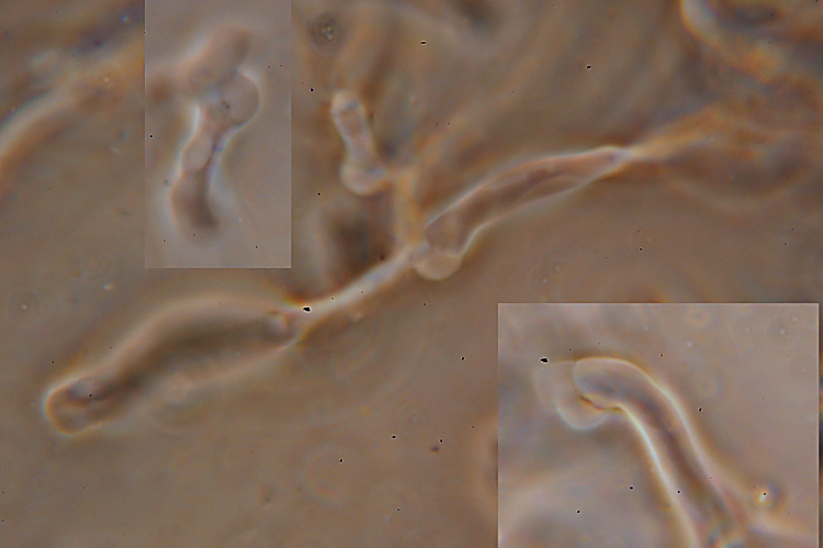 Postia da determinare (Postia rancida)